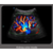 MSLCU32W cheap CW PW cardio ultrasound scanner for sale